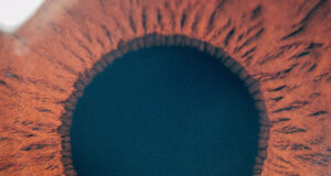 Don’t Miss Eyes On Glaucoma 2024: The Biggest Virtual Glaucoma Event of the Year