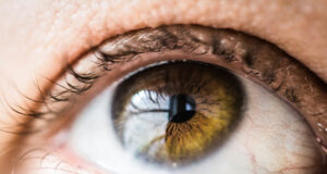 Dry Eye Awareness Month: Free DED Resources from Prevent Blindness