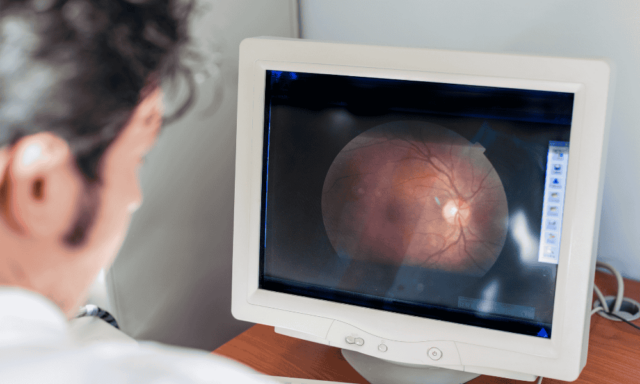 Optometrist looking at an image of a retina on a monitor