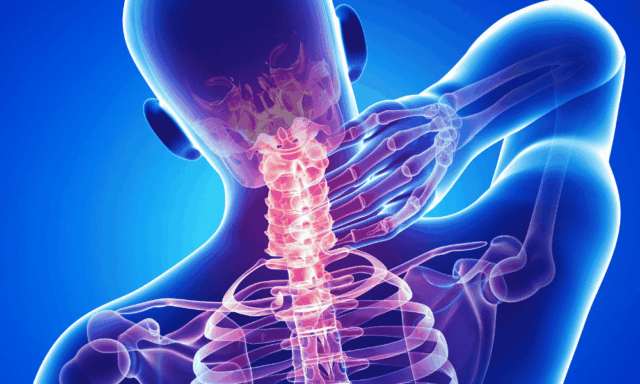 A person with neck and back pain, depicted by an x-ray view of the affected area