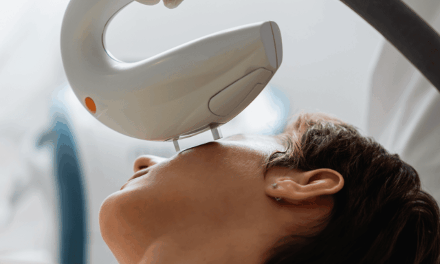 Woman receiving IPL therapy
